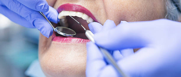 Best Broken or Cracked Tooth Emergency Dentist in Great Notch, NJ